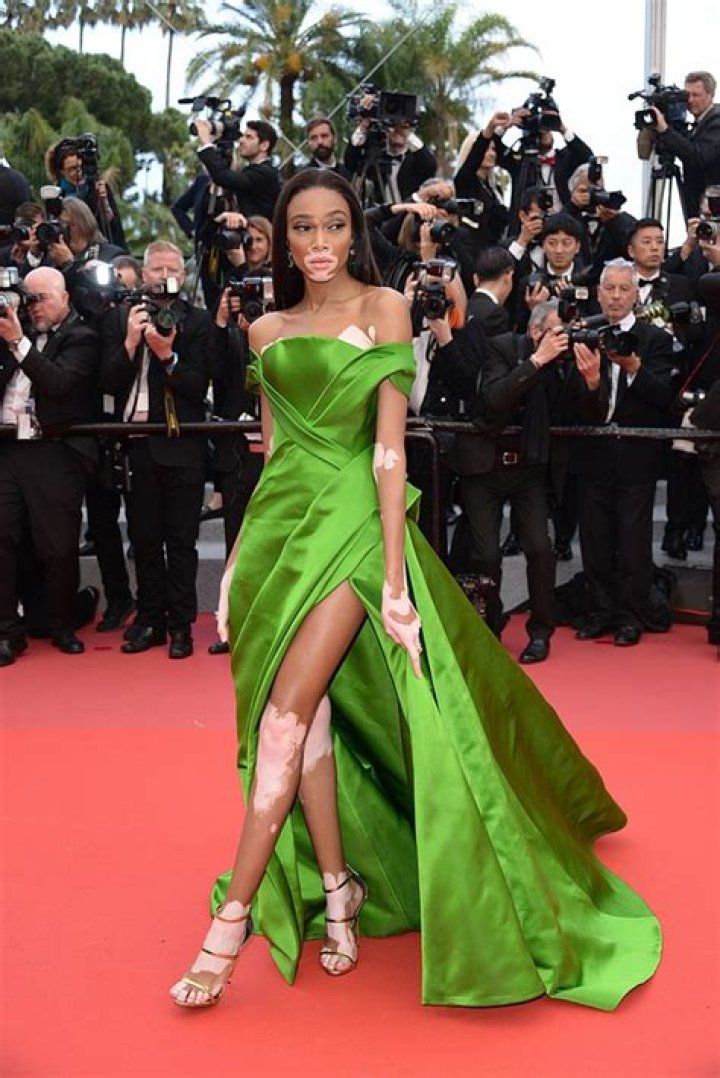 Thigh-High Slit Gowns At Cannes: Pics