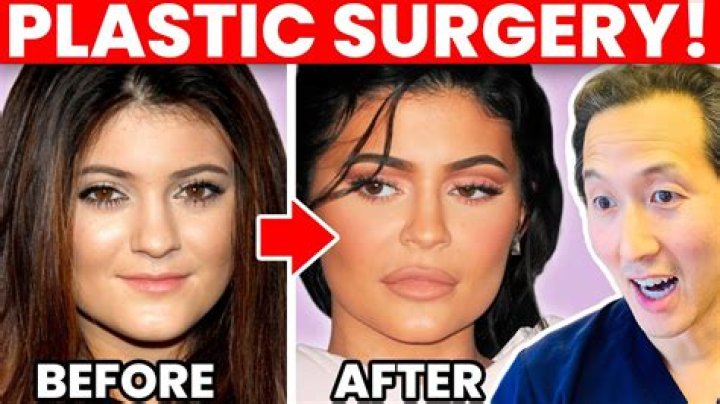 Did Kylie Jenner Get Butt Implants? — Plastic Surgeon Speaks – Hollywood Life