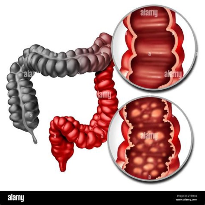 Diem Brown Knew She Had Colon Cancer Before ‘The Challenge’