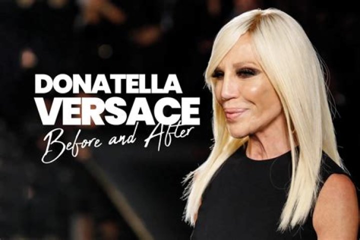 Donatella Versace’s Plastic Surgery — Experts Weight In – Hollywood Life