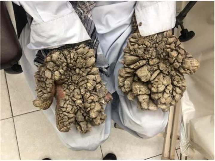 Catherine Reveals Her Cancer Has Progressed — Recap – Hollywood Life