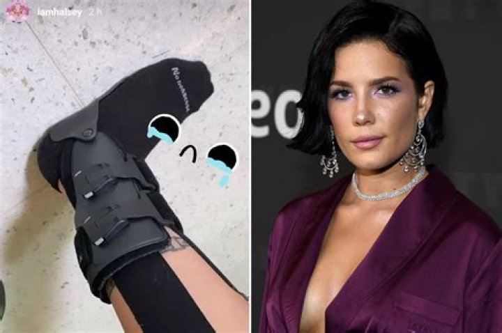 Halsey Reveals She Fractured Her Ankle While Loading Her Dishwasher In Quarantine — Watch