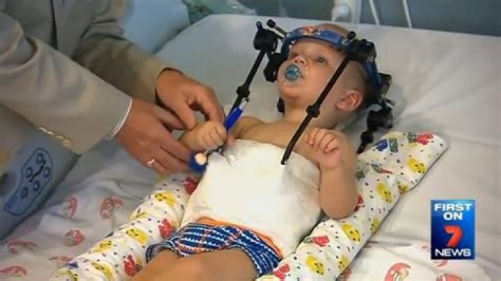 Internal Decapitation — Toddler’s Head Reattached After Crash – Hollywood Life