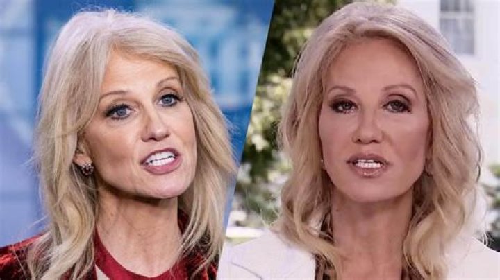 Kellyanne Conway’s Rumored Plastic Surgery Explained By Doctor – Hollywood Life