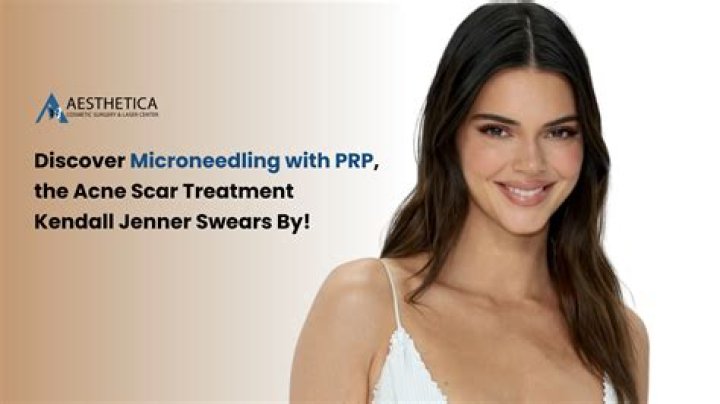 Kendall Jenner Reveals: My Acne Was So Bad I Couldn’t Look People In The Eye