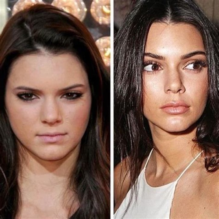 Nose Job Evidence — Did She Get Plastic Surgery? – Hollywood Life