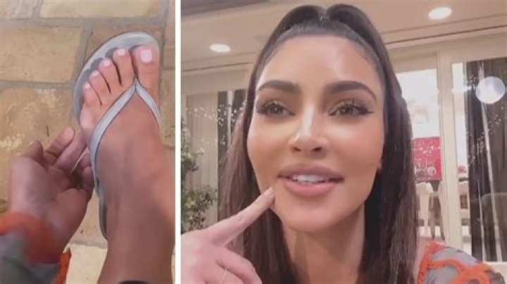 Kim Kardashian’s Apparent Extra ‘Sixth’ Toe Explained By Foot Doctor – Hollywood Life