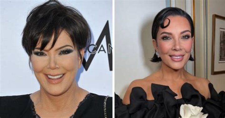 [PICS] Kris Jenner Plastic Surgery — Did Kris Get Fillers? – Hollywood Life