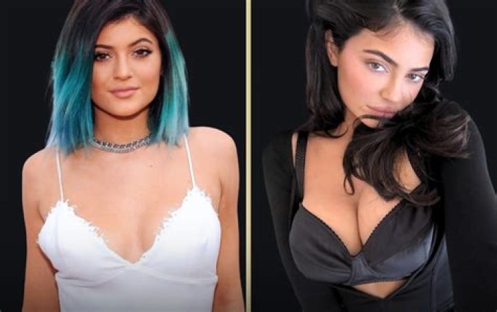 Breast Implants? Plastic Surgeons Weigh In – Hollywood Life