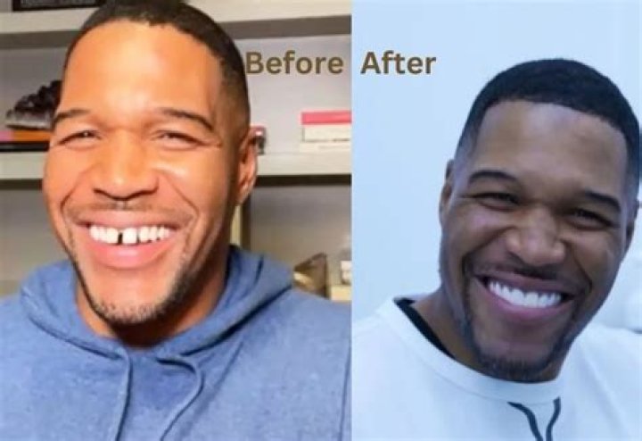 Michael Strahan Reveals If Fixed Tooth Gap Is A Joke – Hollywood Life