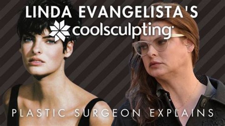 Model Linda Evangelista Was ‘Disfigured’ After Cosmetic Procedure – Hollywood Life