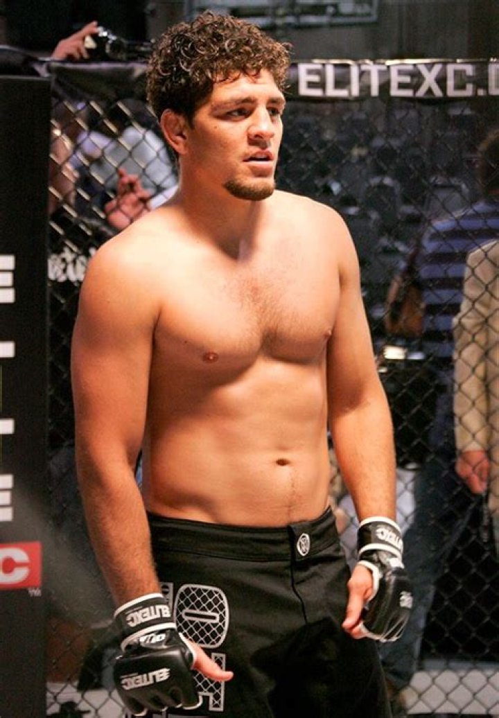 Nick Diaz: UFC Star Brutally Attacked In Las Vegas Nightclub Brawl