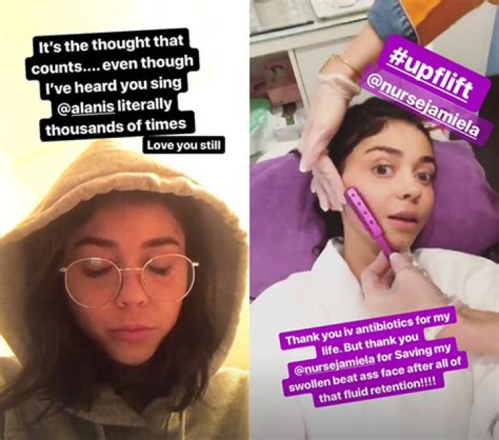 Sarah Hyland’s Swollen Face Smoothed Out By Nurse Post-Hospitalization – Hollywood Life