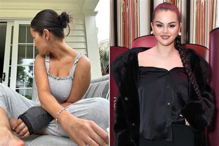 Selena Gomez Fans Fear For The Singer’s Health After She’s Spotted With A Tube In Her Arm During IG Live