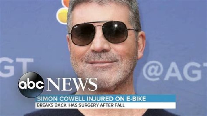 Simon Cowell, 61, Reveals Brutal Scar On His Back In Shirtless Pics After Bike Accident & Surgery