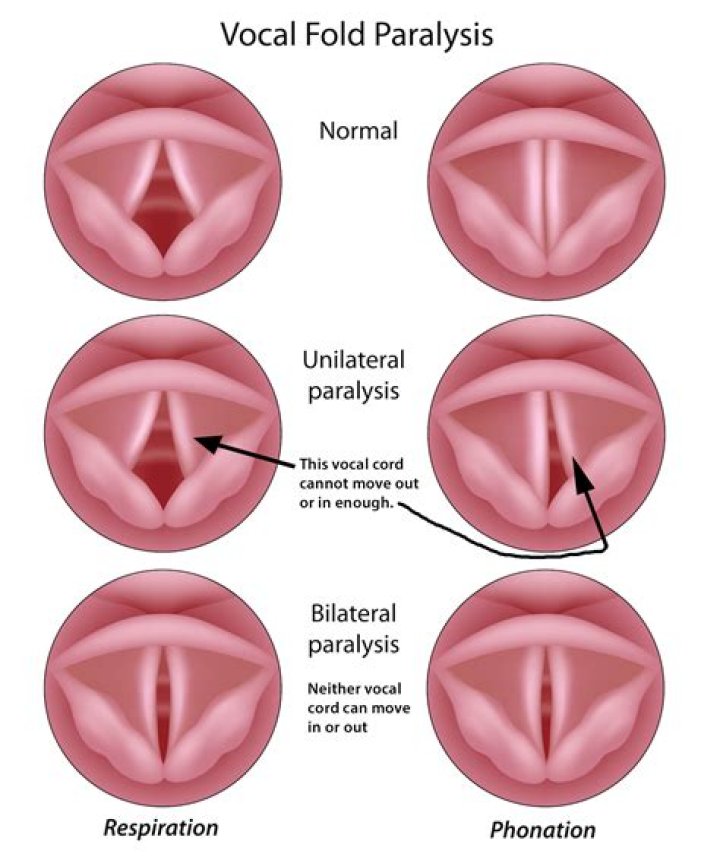 All About His Vocal Cord Injury and Updates – Hollywood Life