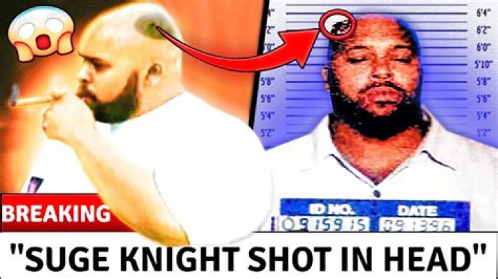 [PICS] Suge Knight’s Surgery Scar — Graphic Photos Of Bullet Wounds & More – Hollywood Life
