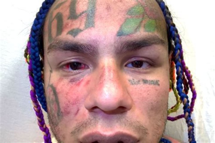 Tekashi69: Cops Reportedly Believe He Was Flaunting $750k Chain & $20k In Cash Before Beatdown
